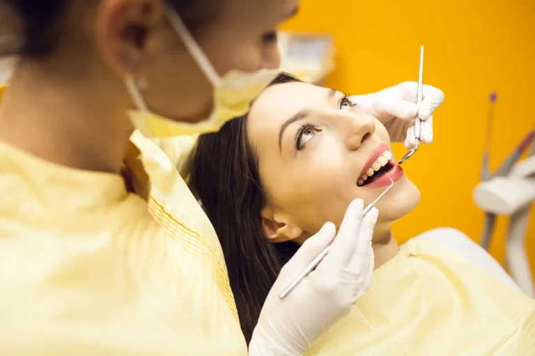 Composite Fillings