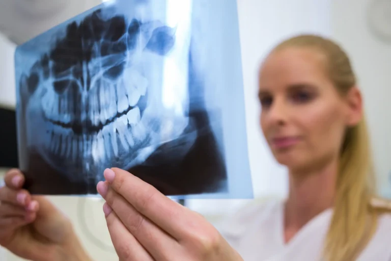 Digital Radiography