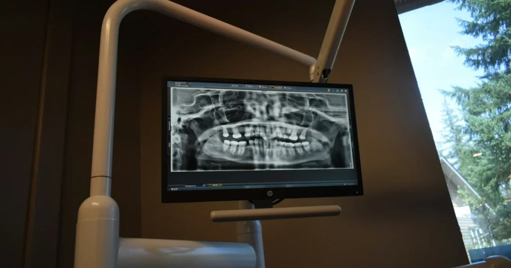 Panoramic dental x-ray of the full upper and lower jaw displayed on a monitor in a dental operatory